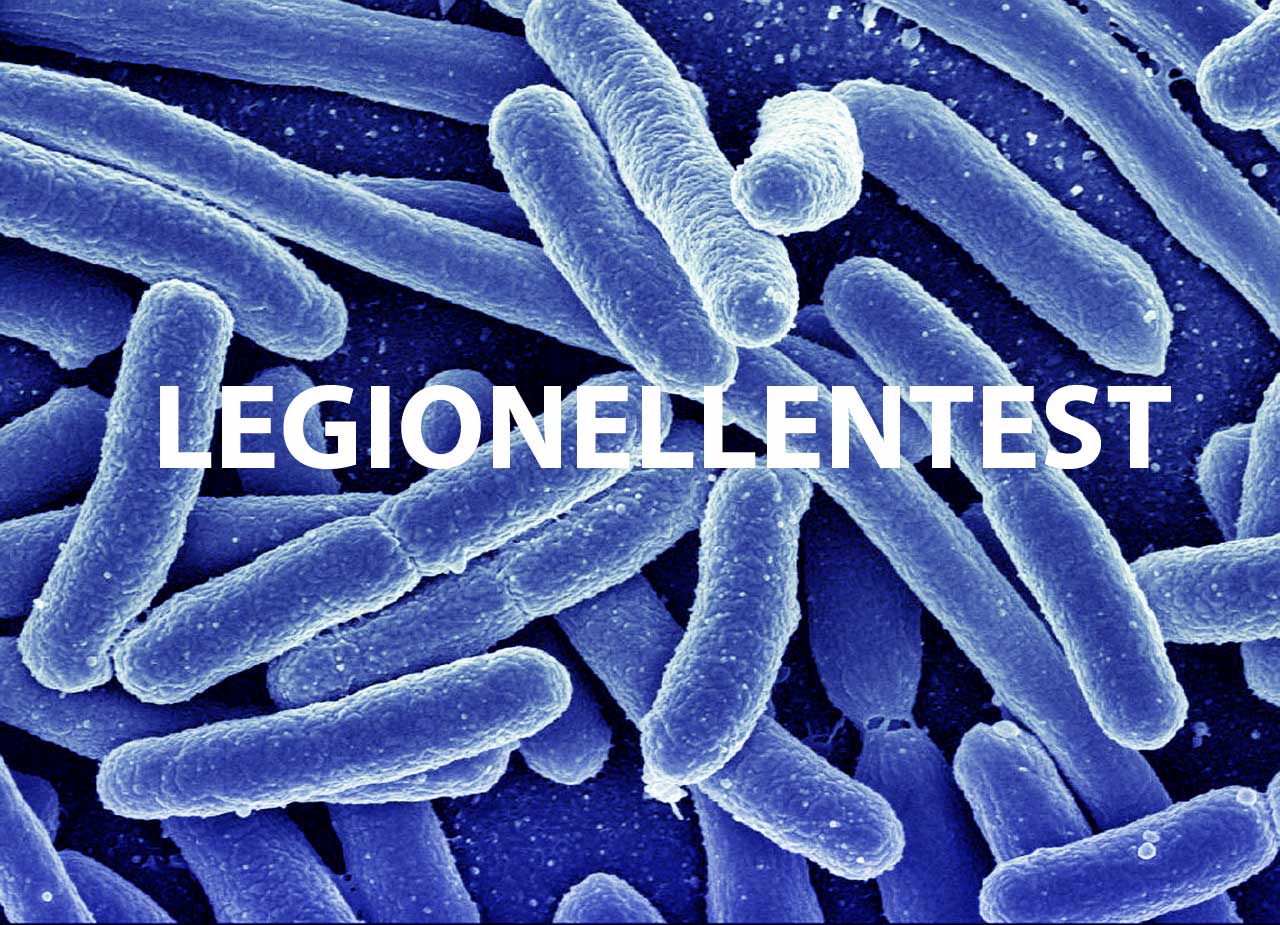 Legionellentest – Wasseranalyse & Wasserprüfung auf Legionellen